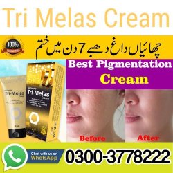 Tri Melas Cream Price In Pakistan  03003778222
